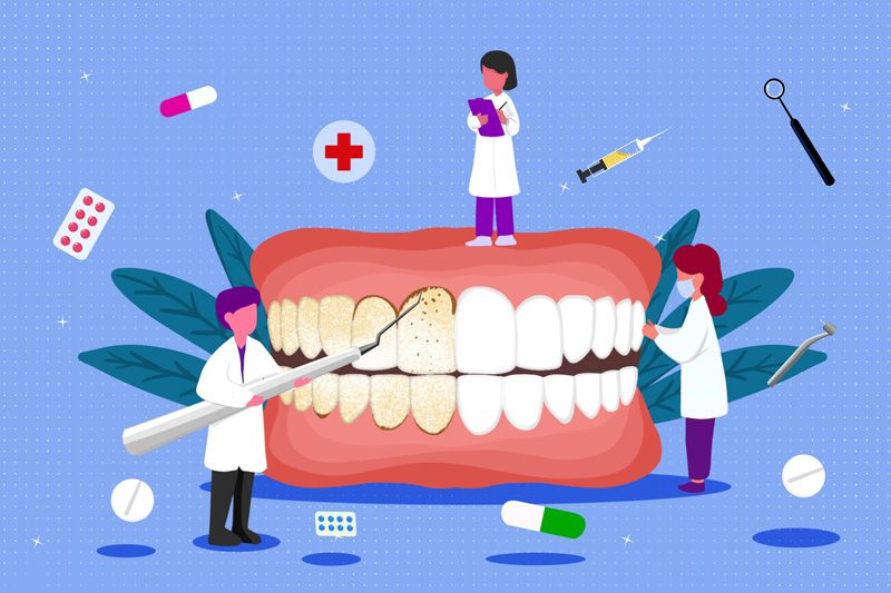 兒童牙齒怎么護理 牙齒護理常識